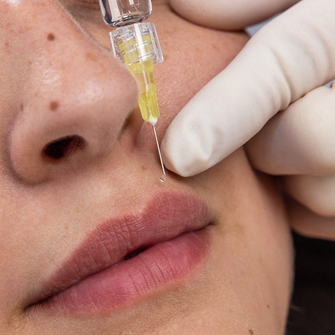 sublimationdusourire