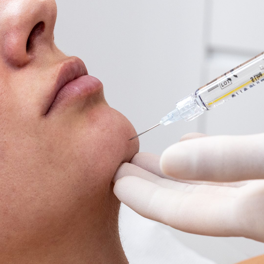 sublimerovaleduvisage