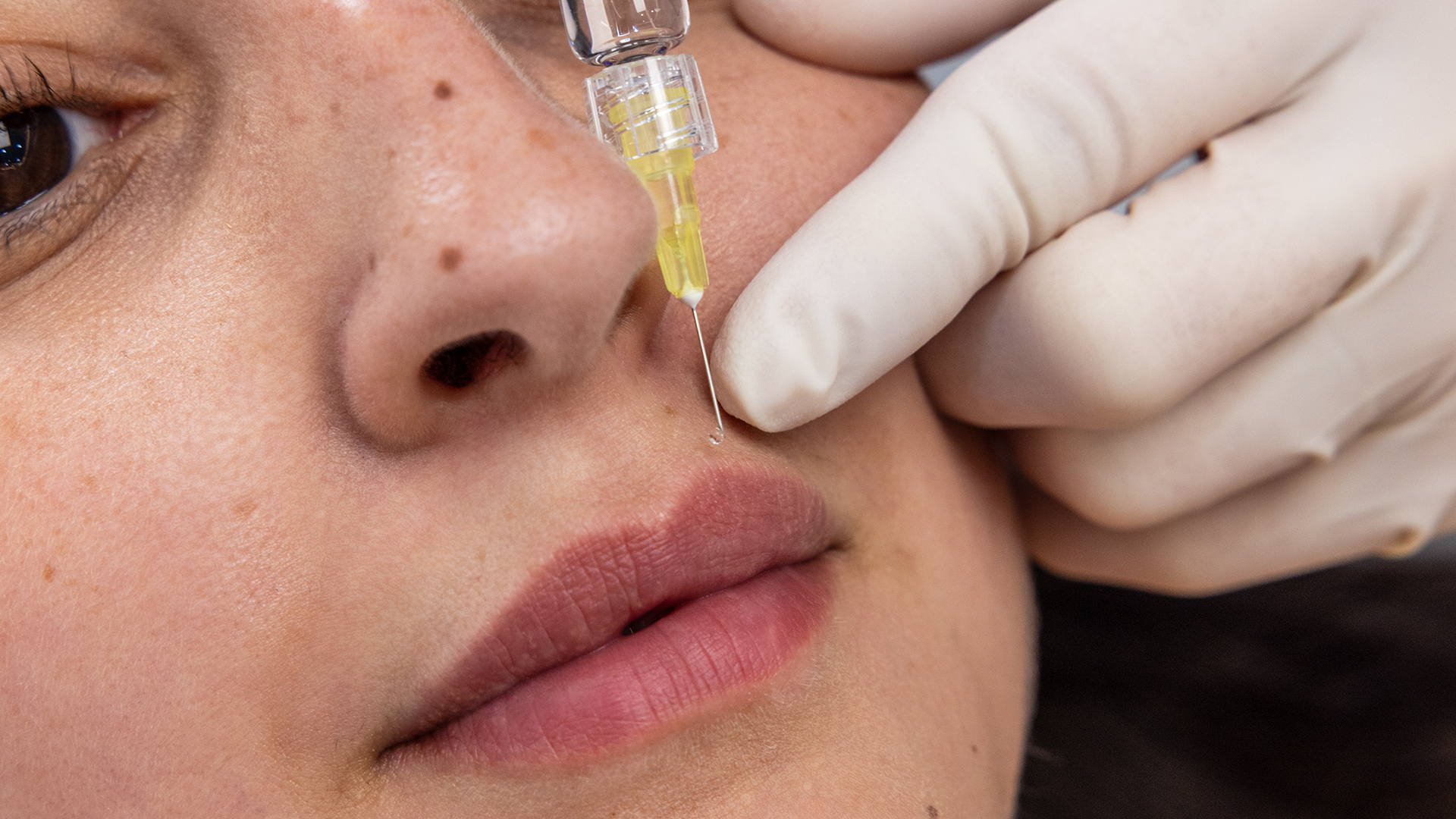 sublimationdusourire